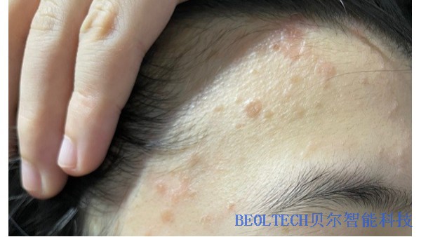 BEOL青島貝爾智能帶您了解醫(yī)美用的液氮罐2022.4.14